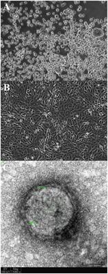 Co-circulation of a Novel Dromedary Camel Parainfluenza Virus 3 and Middle East Respiratory Syndrome Coronavirus in a Dromedary Herd With Respiratory Tract Infections